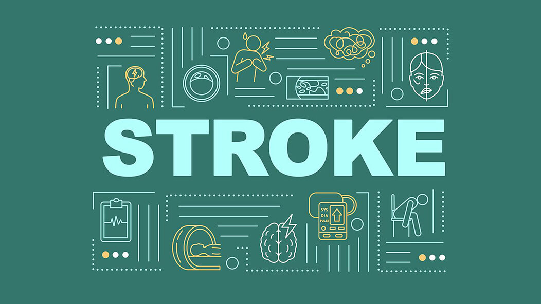 About Stroke