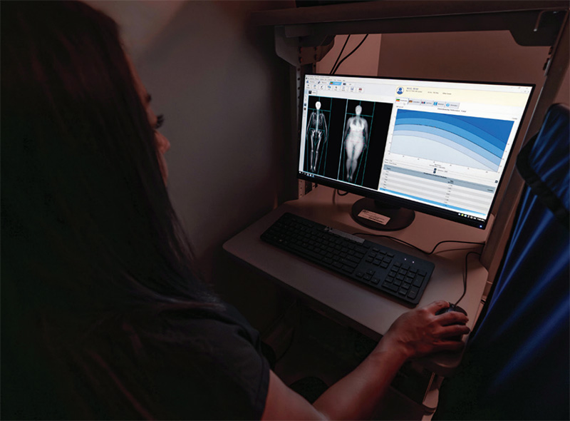 A medical professional reviews a patient's DEXA scan results on a computer.